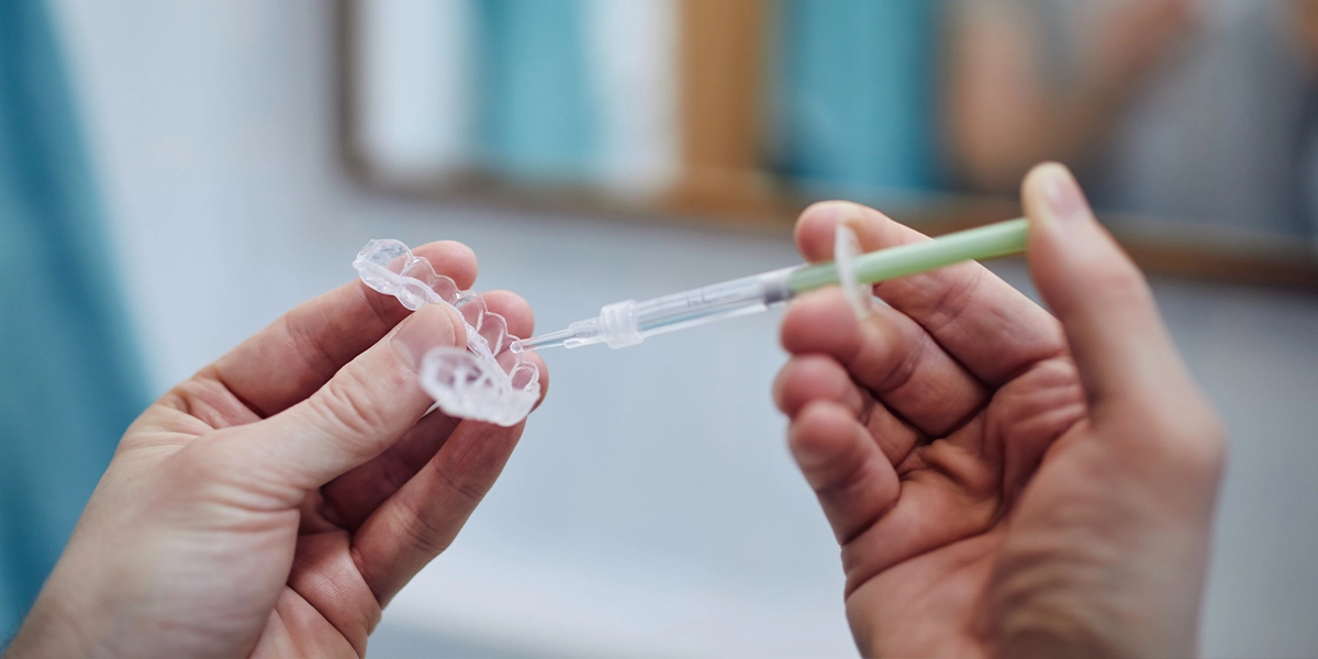 薬剤の濃度で変わるホワイトニングでしみるリスク