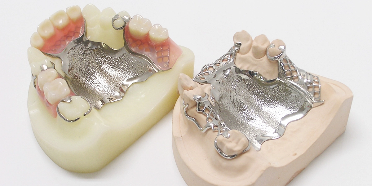 金属床義歯