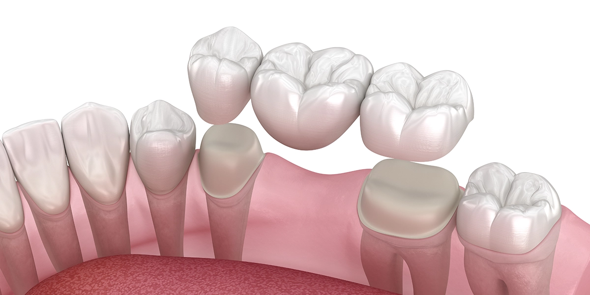 従来の治療法との比較
